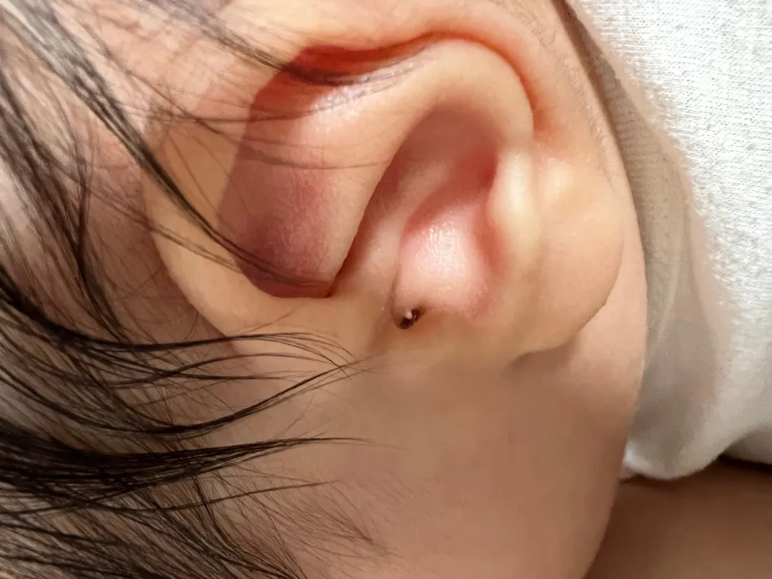 아기귀에 하얀게 생겼는데 뭔지 아시나요?  ㅜㅜ