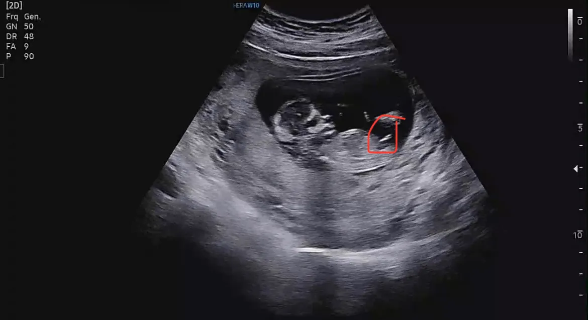 저는 각도법 안볼줄 알았는데.. 이게 혹시 그거일까요???