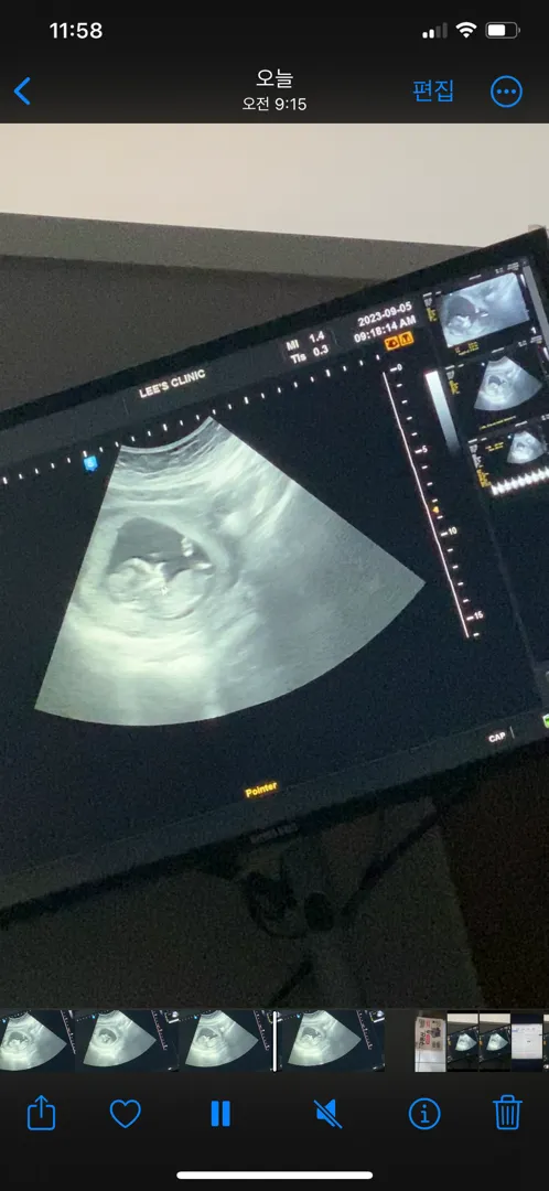 12주4일 각도법 잘보시는 고수님들계신가요?