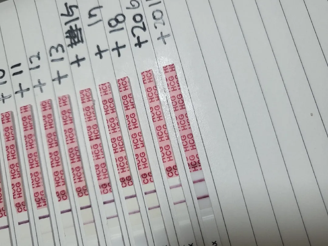 저 어제 초음파 못보고 왓는데 역전일까요