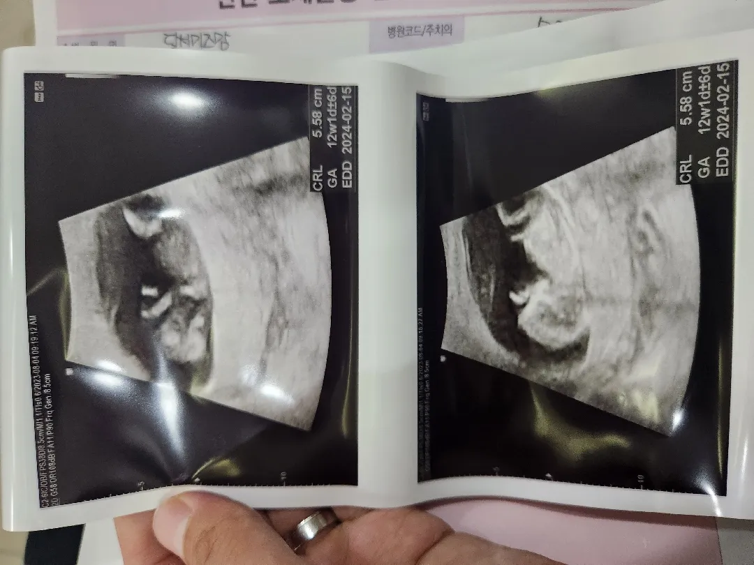 11주6일 각도법으로 봐주실수 있나요?? 