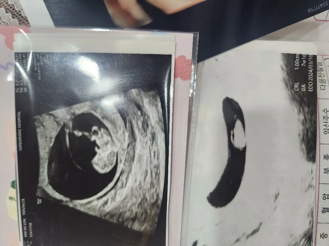 2주만에 팔다리가~?