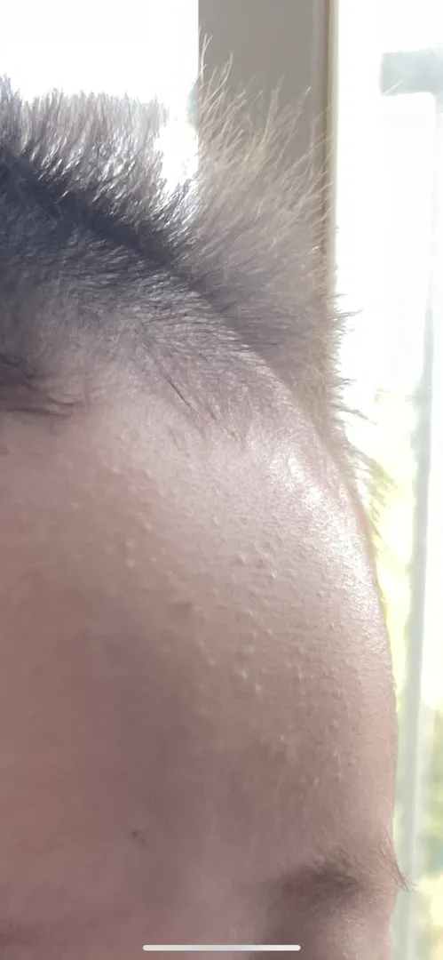 쌀가루 알러지도 있나요?