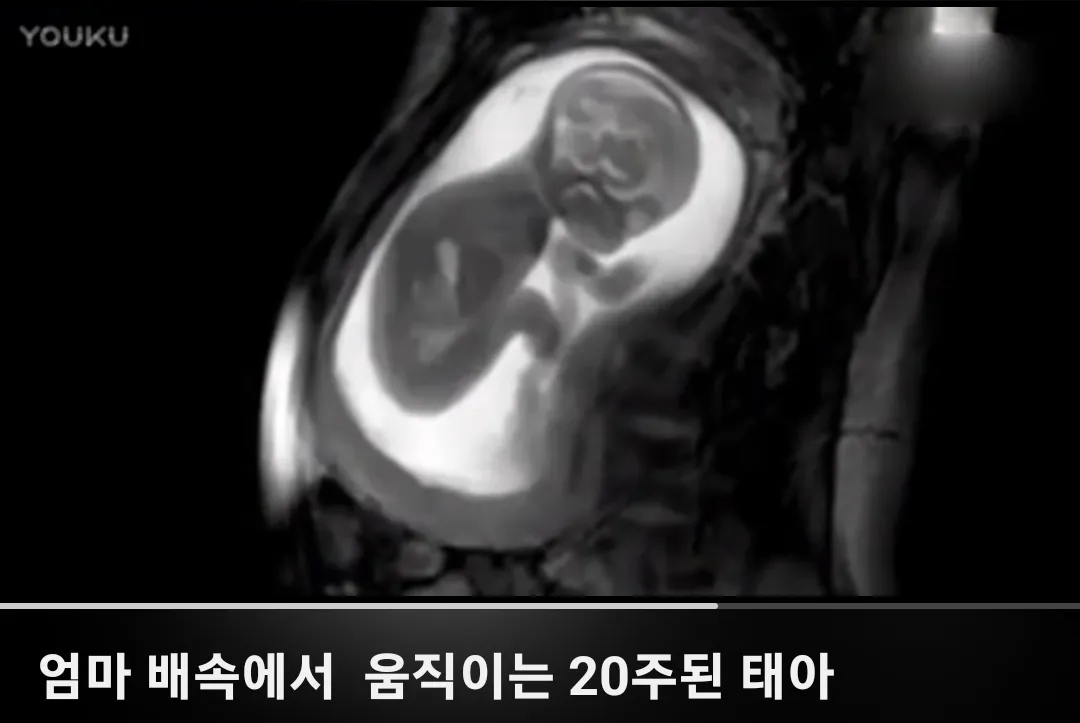 뱃속에서 딸꾹질하는 아가