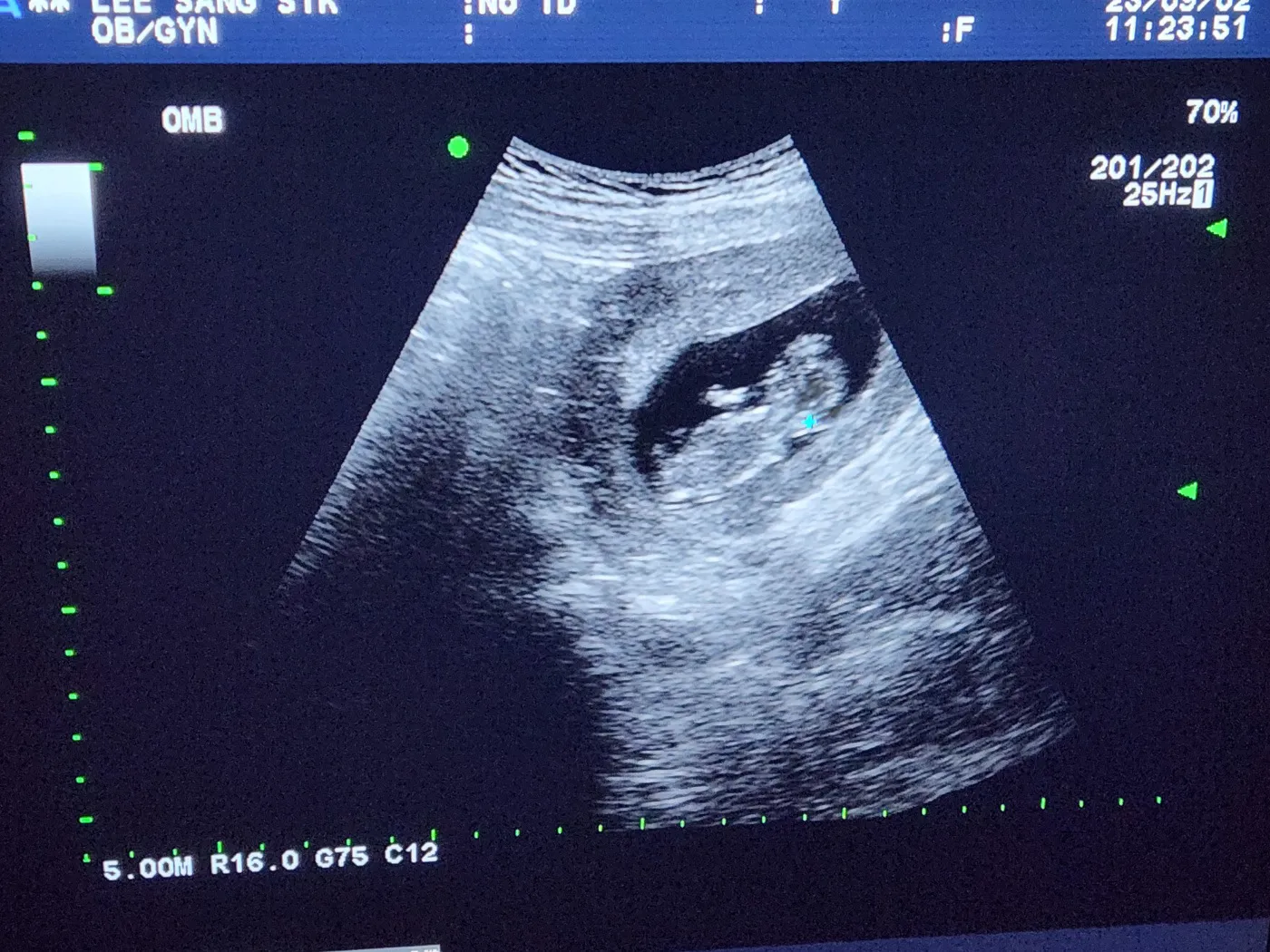 13주들어섯는데 아들딸알수있을까요?