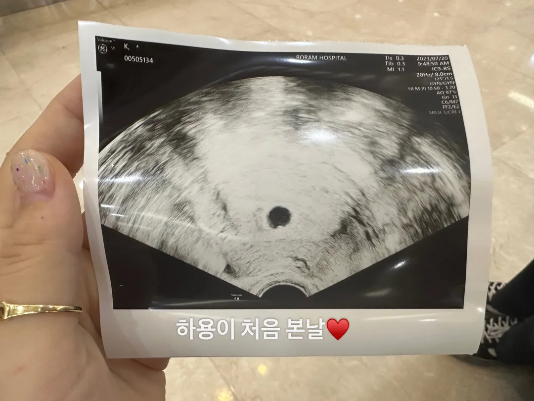 목요일날 처음 병원 다녀왔습니다!♥️