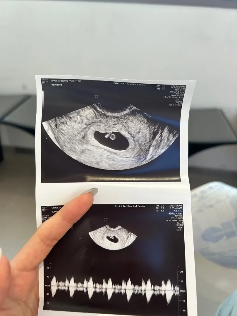 절박유산 진단 받았는데, 많이 좋아졌다네요.