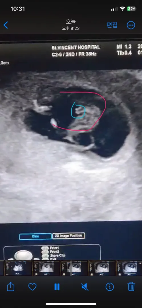 다리사이 삼각점 보이는 거 맞을까요?🥰