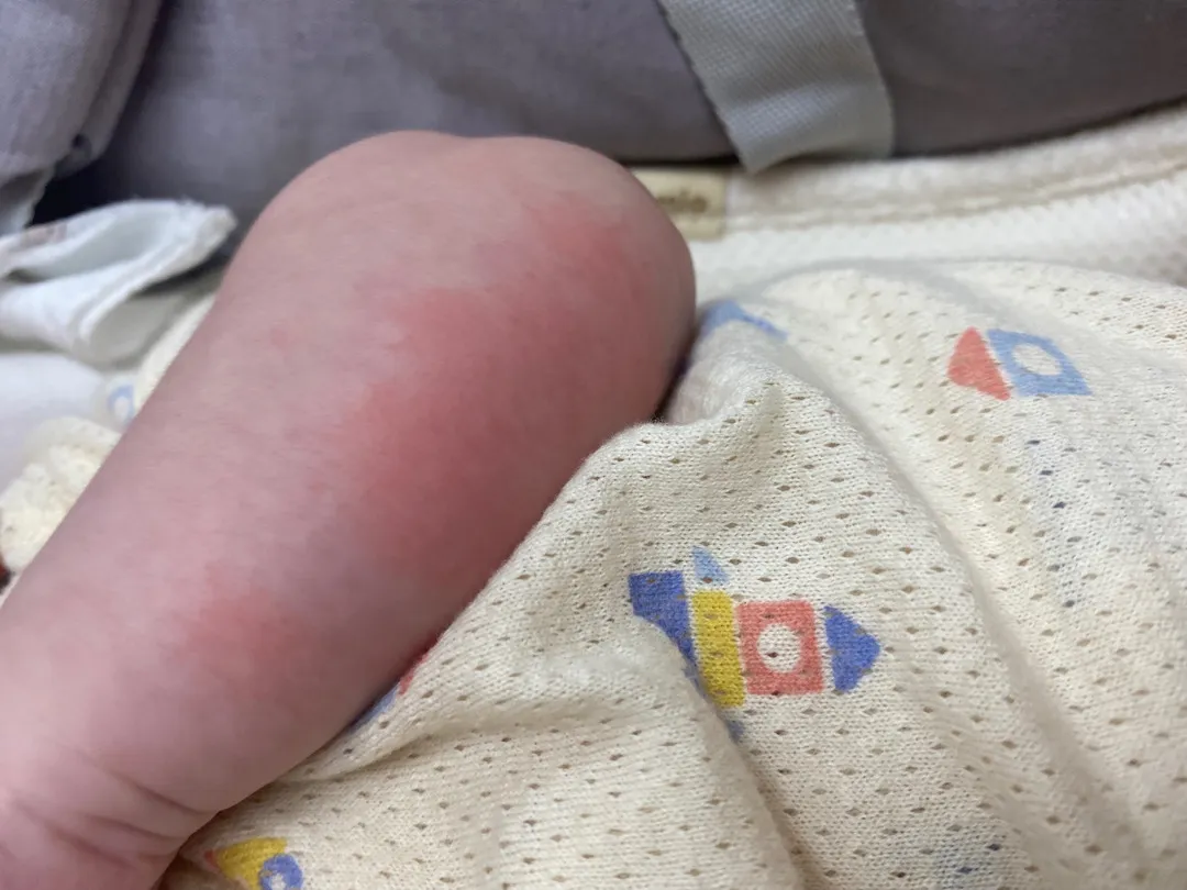 애기 팔좀 봐주세용 ㅠㅠ