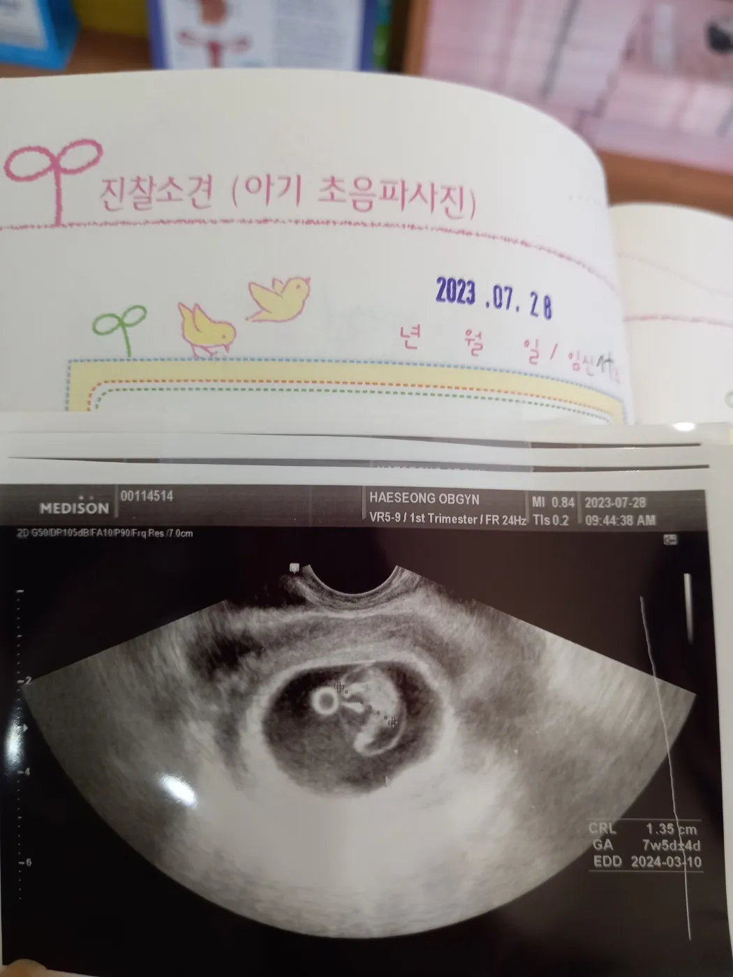 7주차 때 초음파 봤는데 저희 애는 왜케 강낭콩 같죠 ㅋㅋㅋㅋㅋ