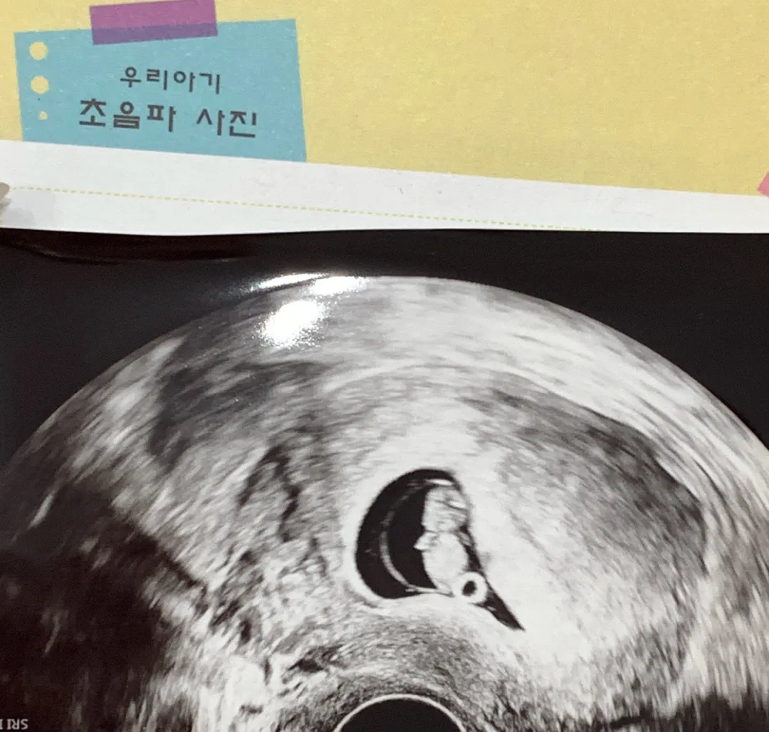 당당한 눈사람 보실 분~ ㅋㅋ