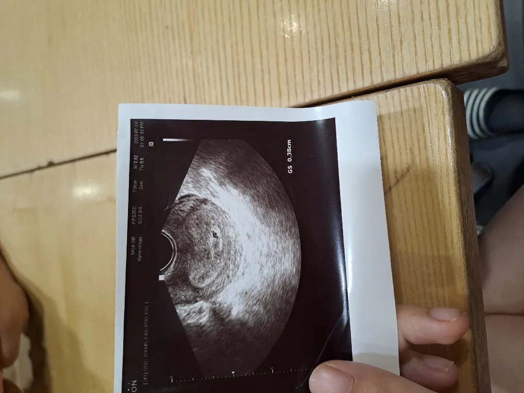 몇주인지 잘모르겠어요