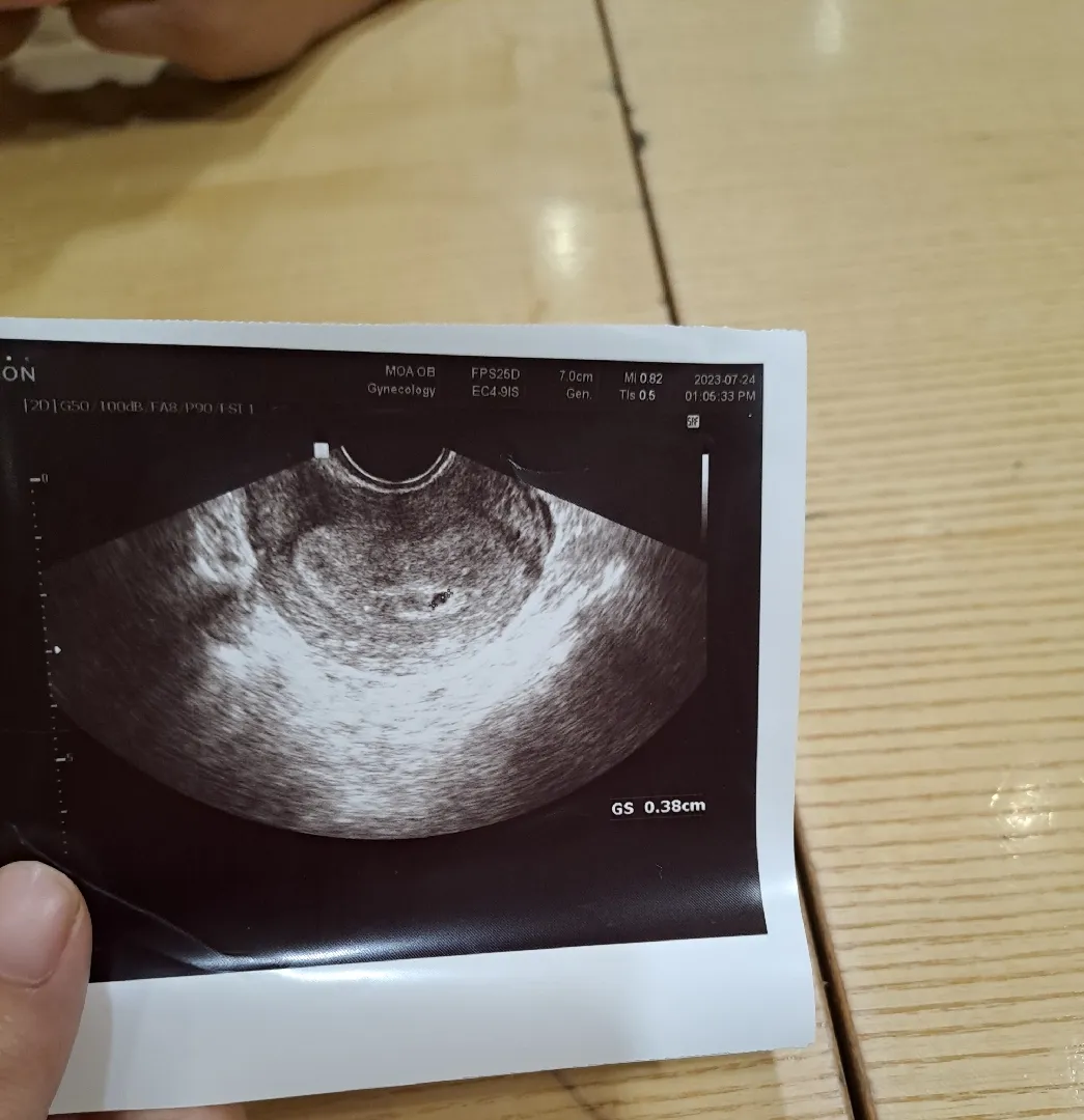 몇주인지 모르겠어요