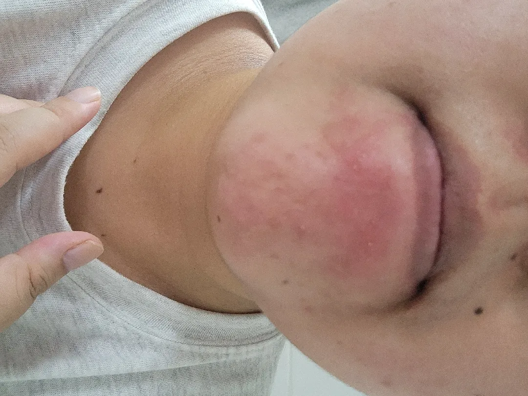 올리기 좀그렇지만..피부상태 ㅠ