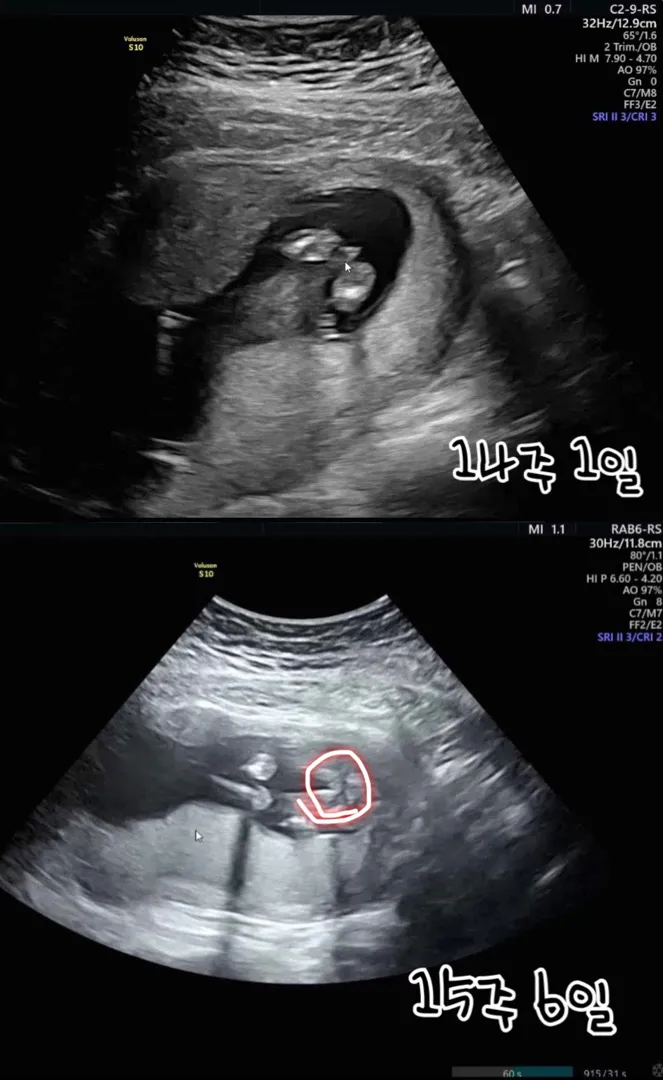 성별 반전일까용…??  🙏🏻