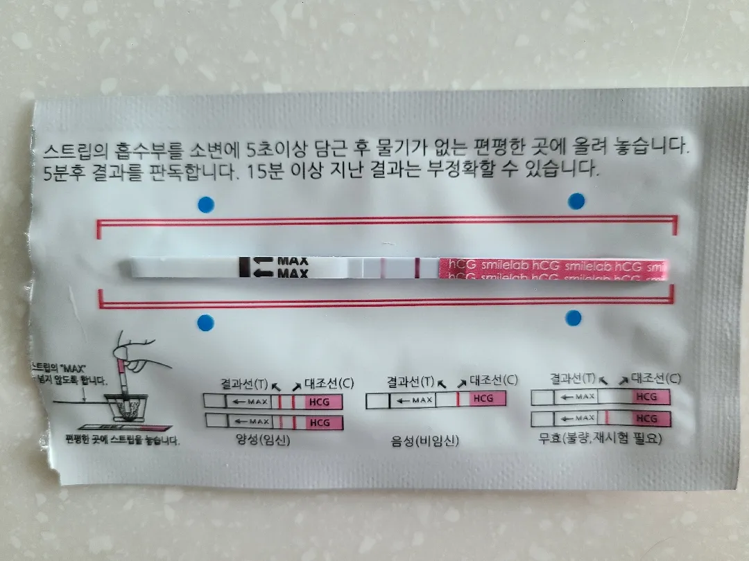 난포주사영향인지 봐주세요..ㅜㅜ