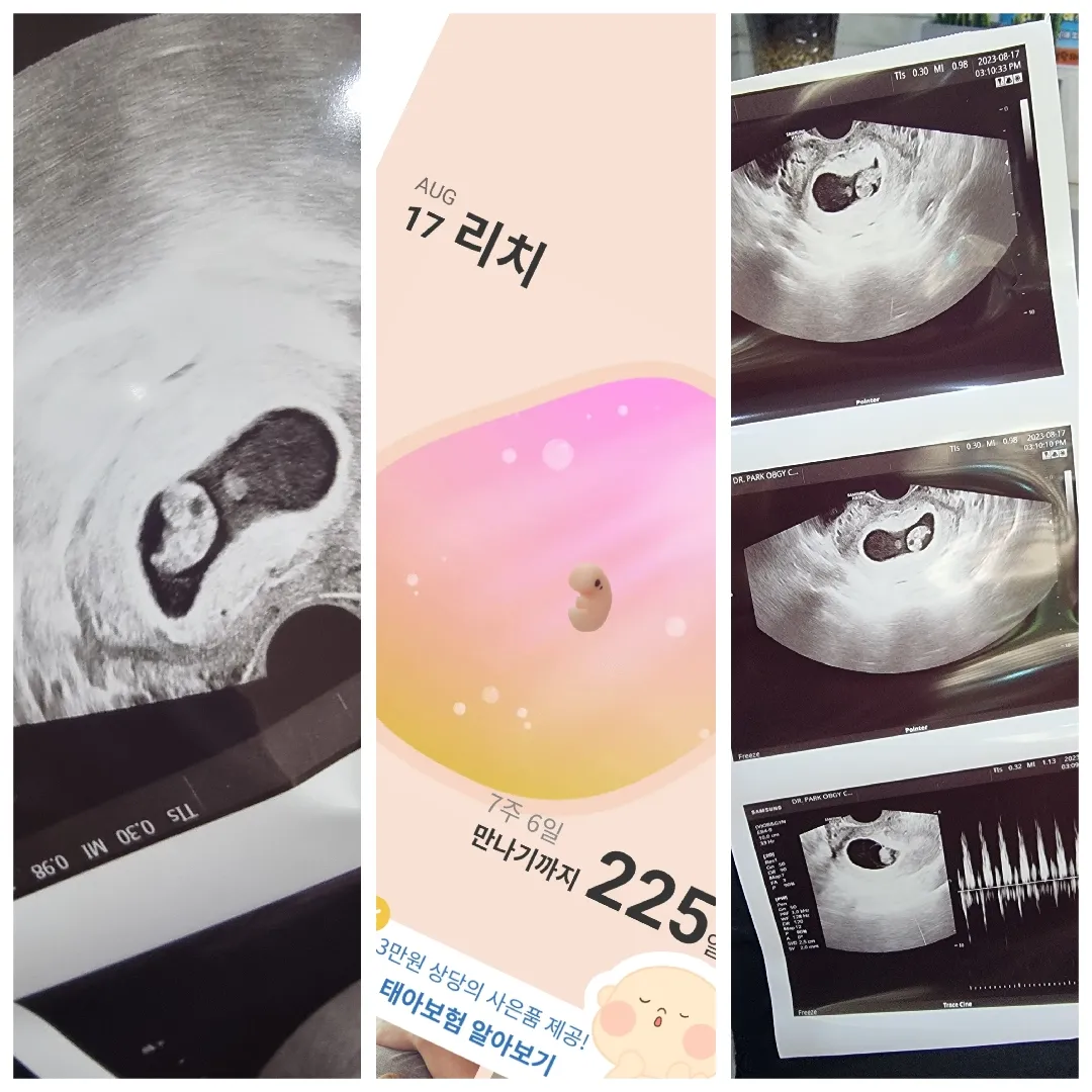 빌리랑 똑같이 크는 우리 리치