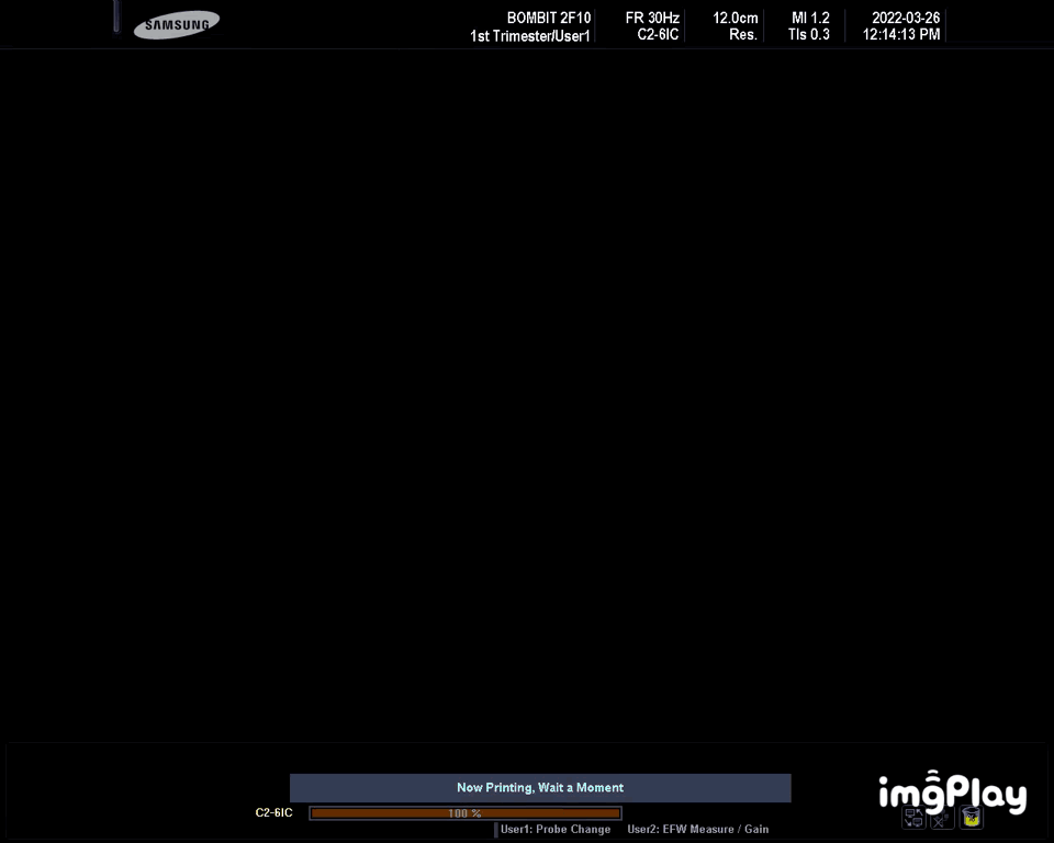 community post image