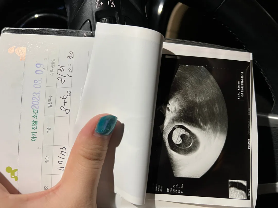 8주6일 열무보고왔어용 💕