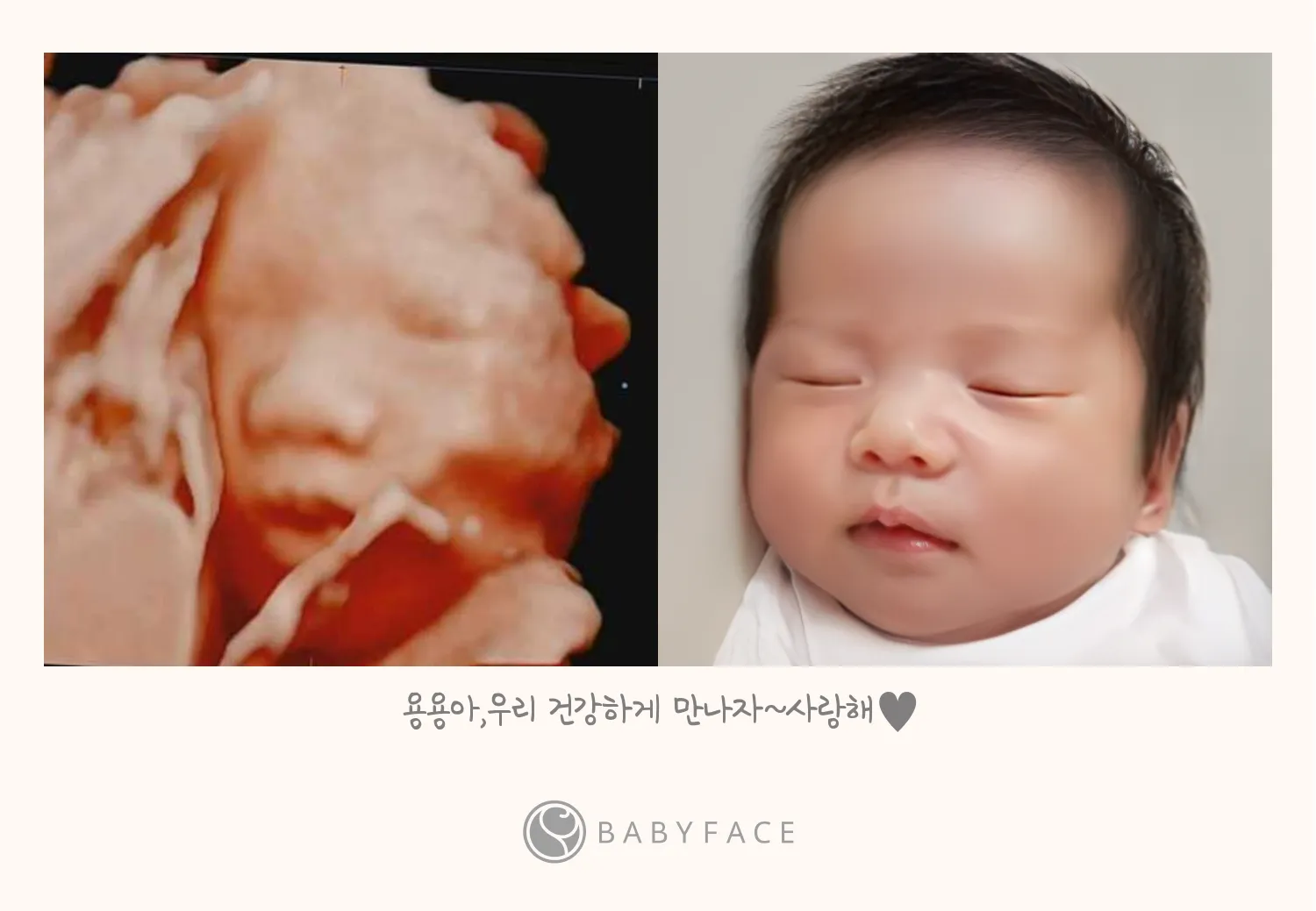 입체초음파 받고 베이비페이스로 아기 얼굴 봤어용😆
