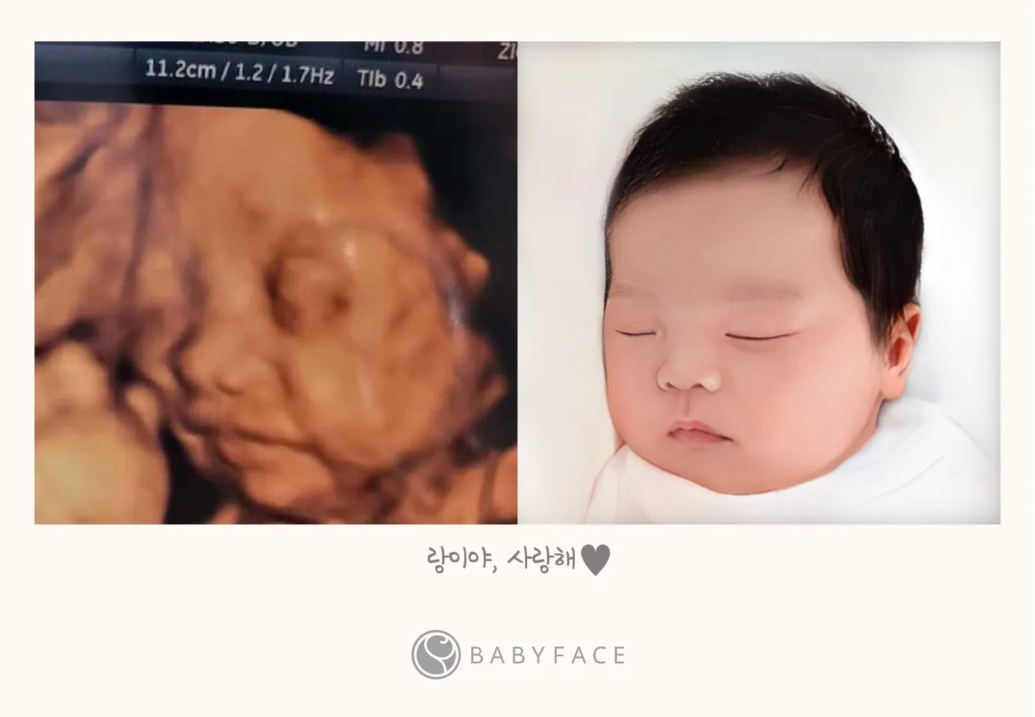 저도 베이비페이스 해봤어요🤭❤️