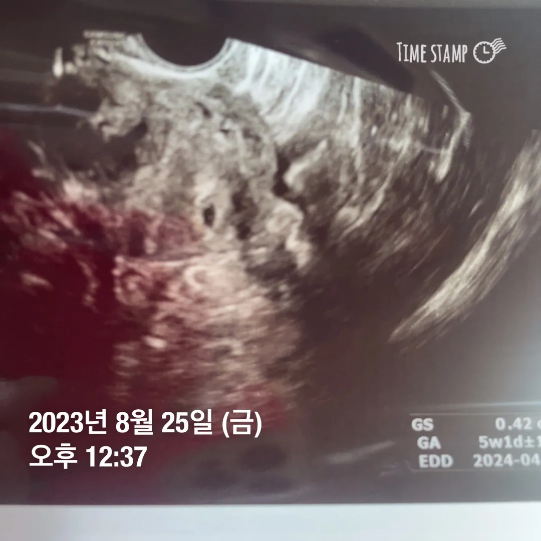 5주2일차에 병원 방문