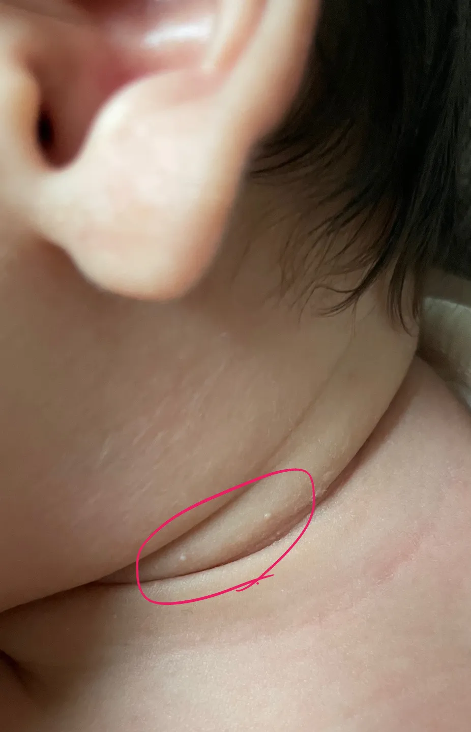 목 뒷부분 사진한번봐주세요😭