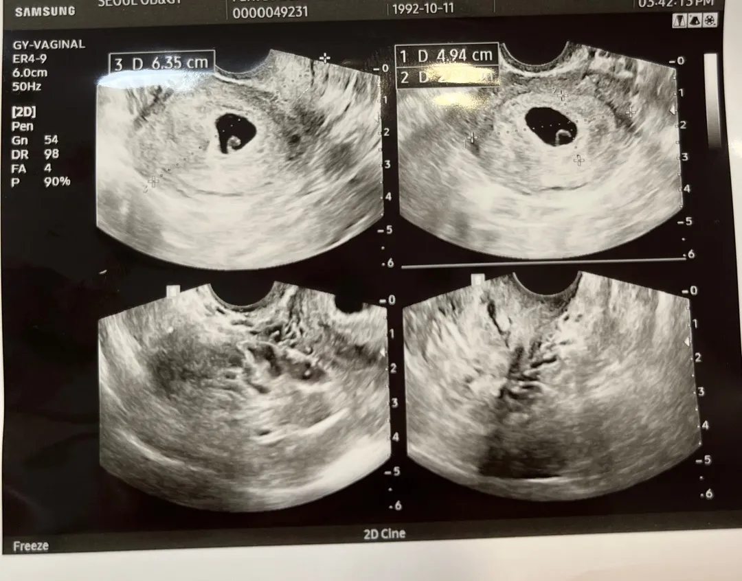 예민한 엄마라 미안해요 ㅠㅠ 