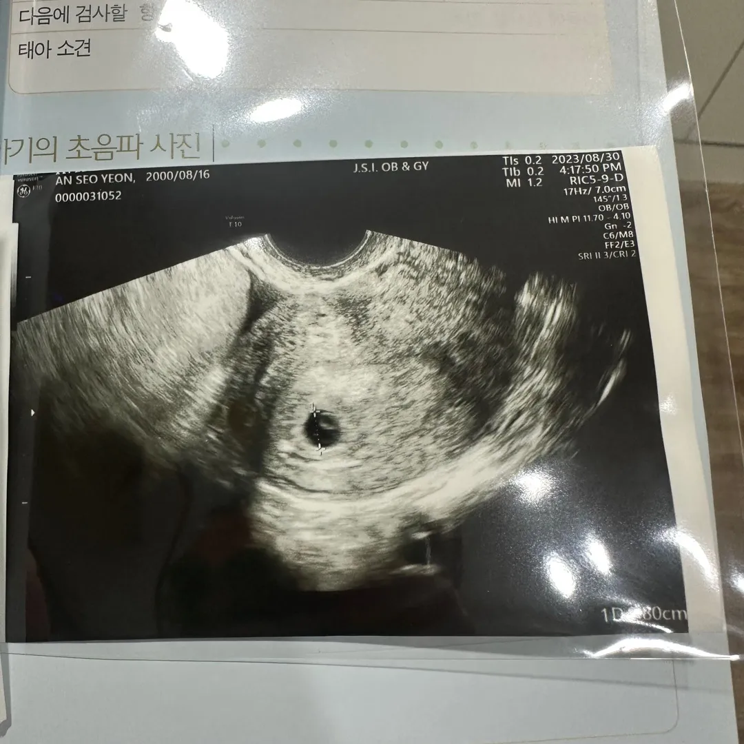 6주 애기집 어떤가요🥺