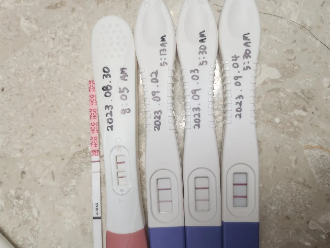 이제 아기집이 보일까요?