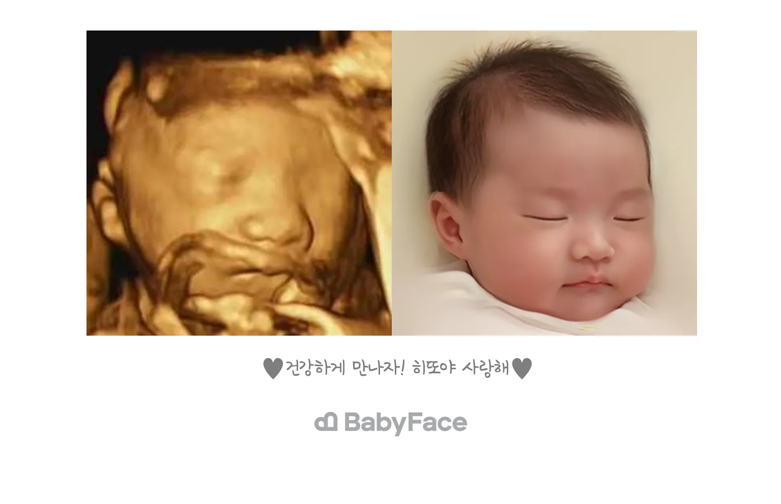 베이비페이스!