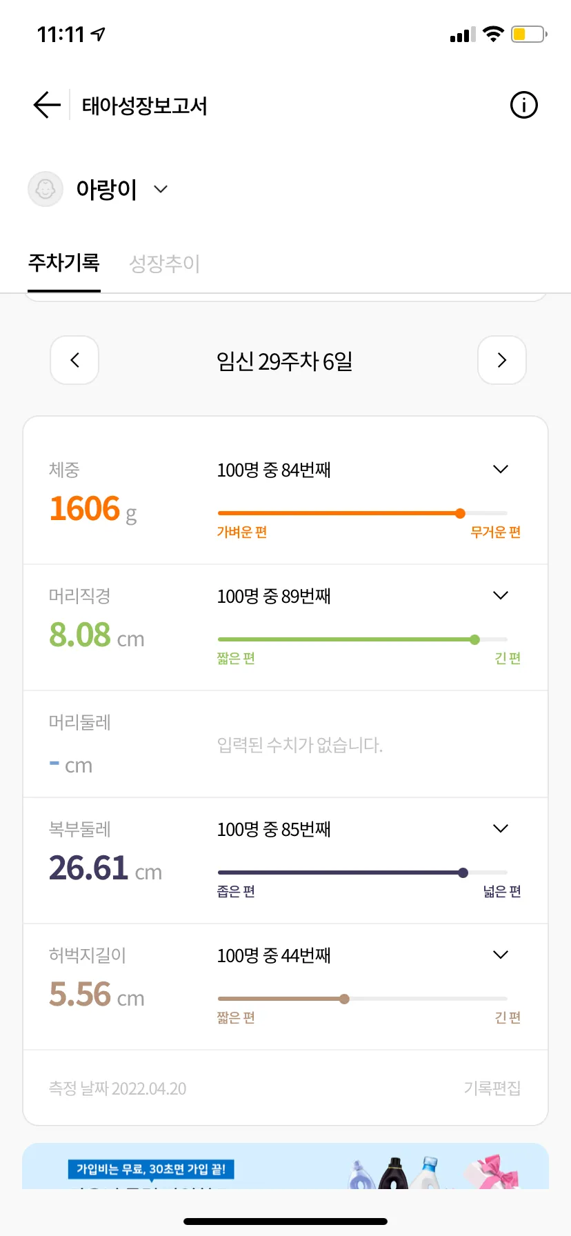 31주 아기 크기