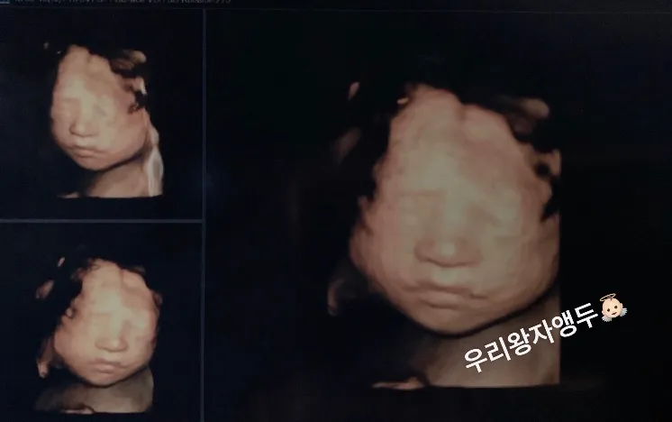새해부터 우리아가와의 만남