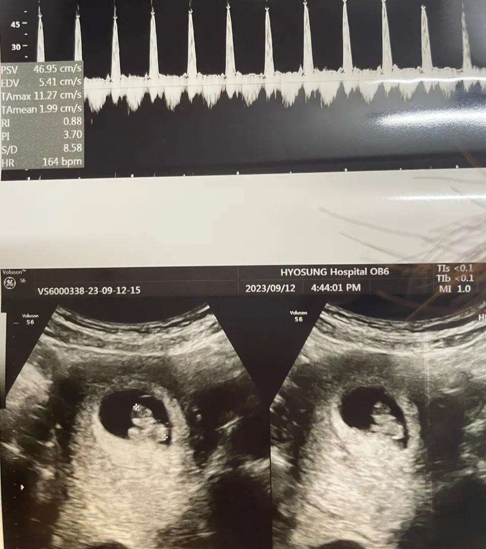 7주6일 🤍