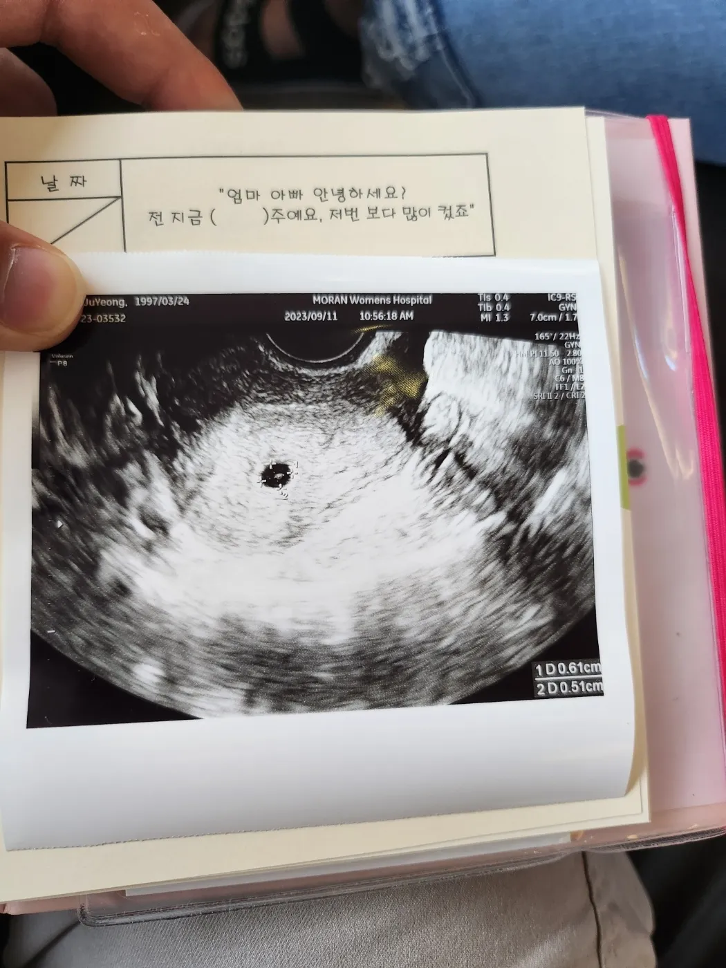 아기집 및 난황 보고 왔어요ㅎㅎ
