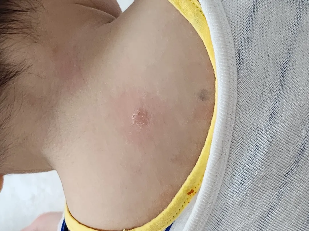 피부 봐주세요 ㅠㅠ