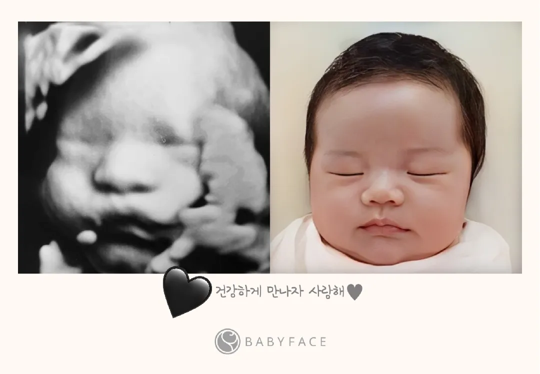 31주 베이비페이스했어요❤