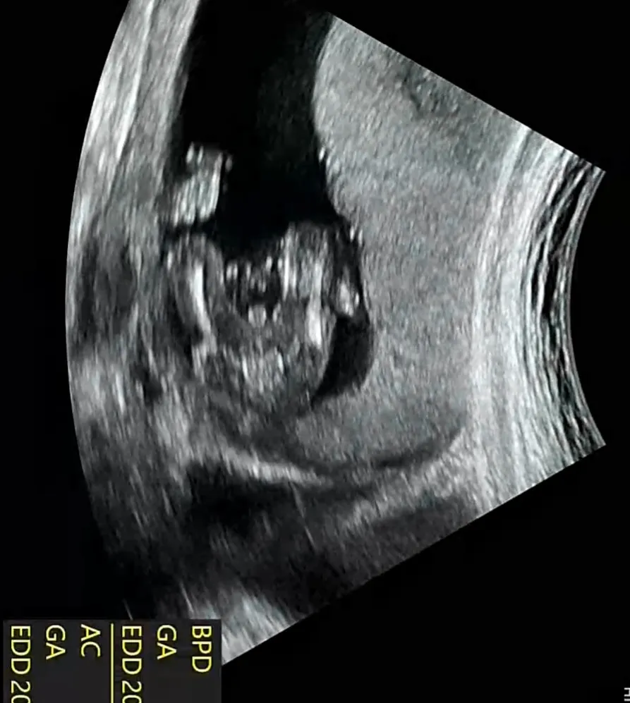 16주 성별이요~~