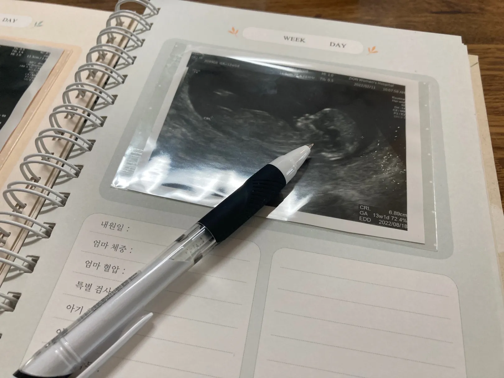 초음파 앨범을 드디어 만들었습니다!!!