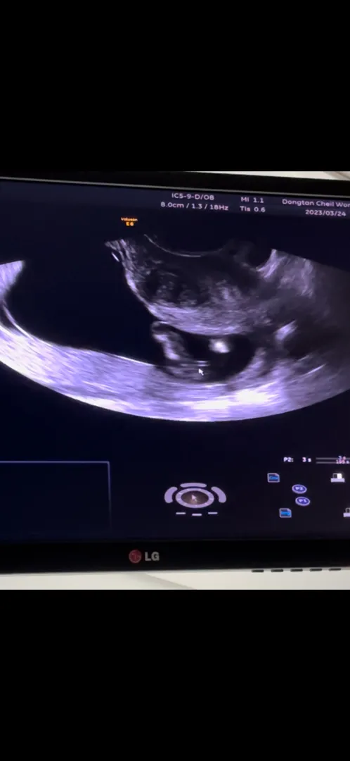 딸일까요?? 저와 비슷하신 분 계신가요??