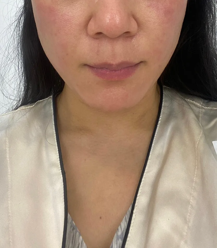 저 처럼 얼굴,목 간지러운 계시나요?