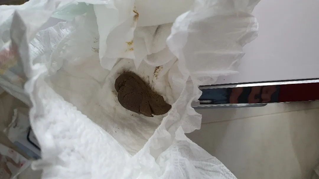 6개월27일째인 아가 똥 괜찮은건가요? (똥사진있어요)