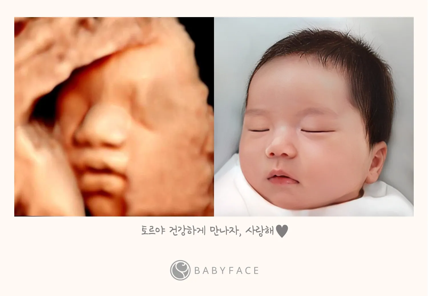 입체초음파로 베이비페이스 했어요~!