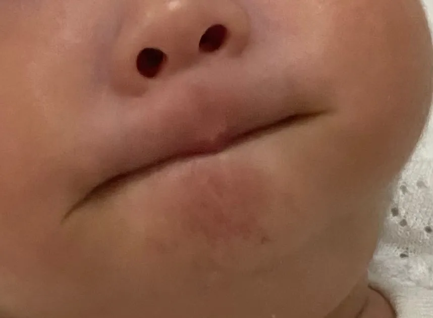 입술을 자꾸 말아넣어요;