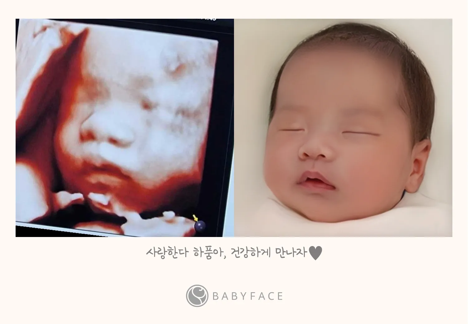 저도 촘파 베이비페이스..ㅎㅎㅎㅎ