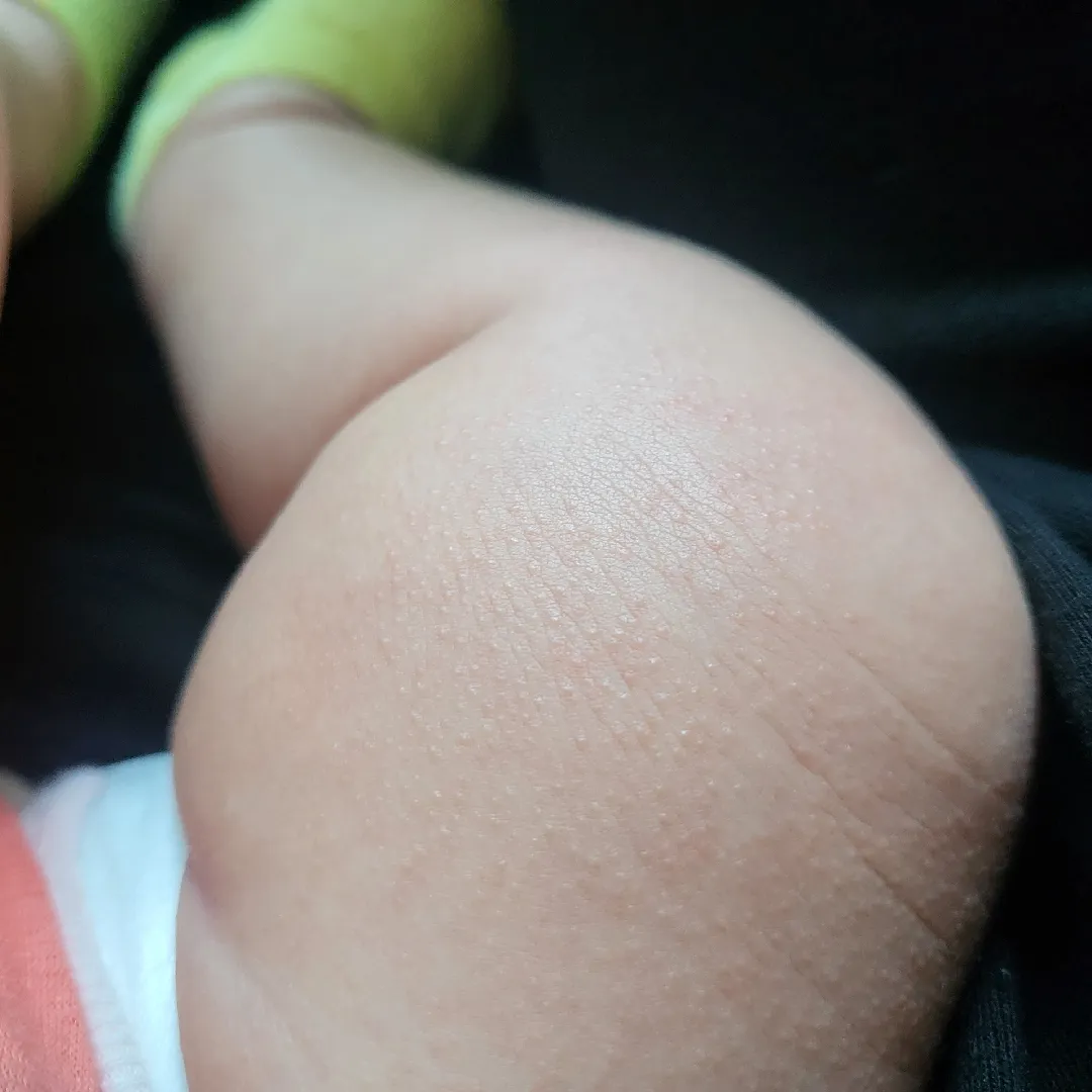 피부 오돌토돌 왜이러는걸까요?ㅠ