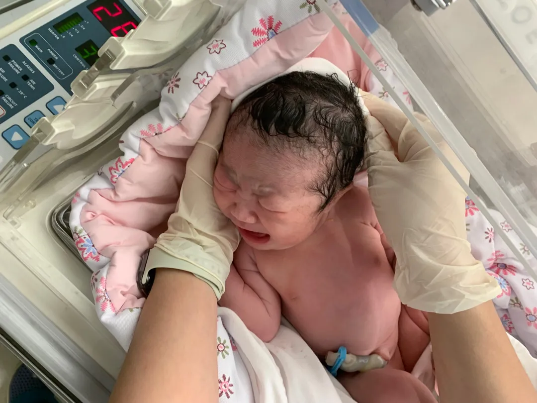 5.31예정일에 유도 진통 없어서 제왕했어요