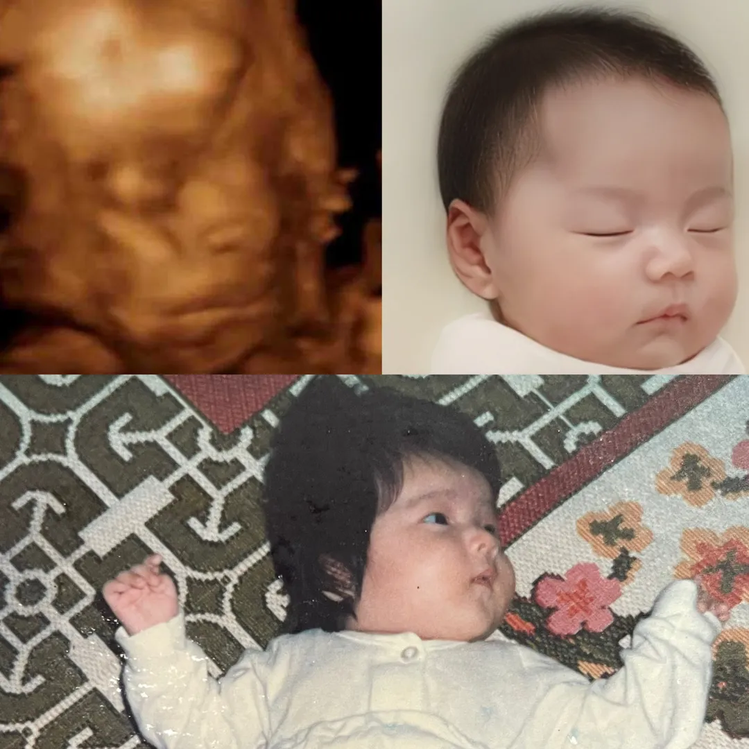 입체초음파로 베이비페이스 해봤어요!😃