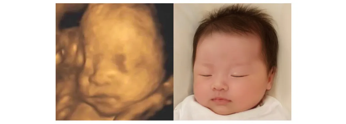 우와!! 베이비페이스 대박이에요!!