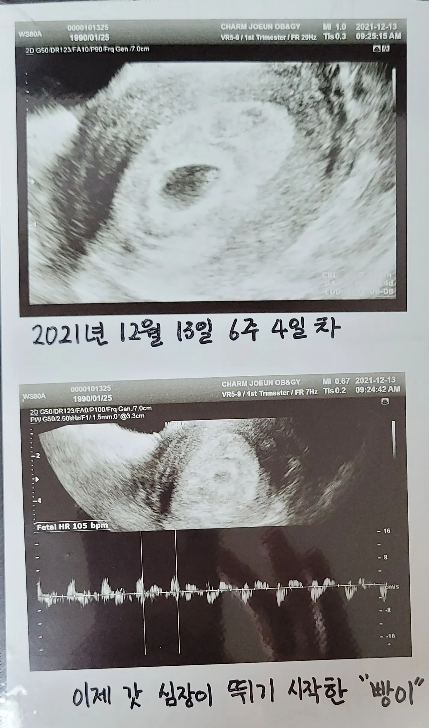 피비침으로 병원행....